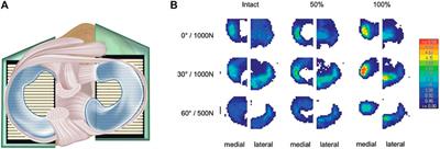 Influence of Menisci on Tibiofemoral Contact Mechanics in Human Knees: A Systematic Review